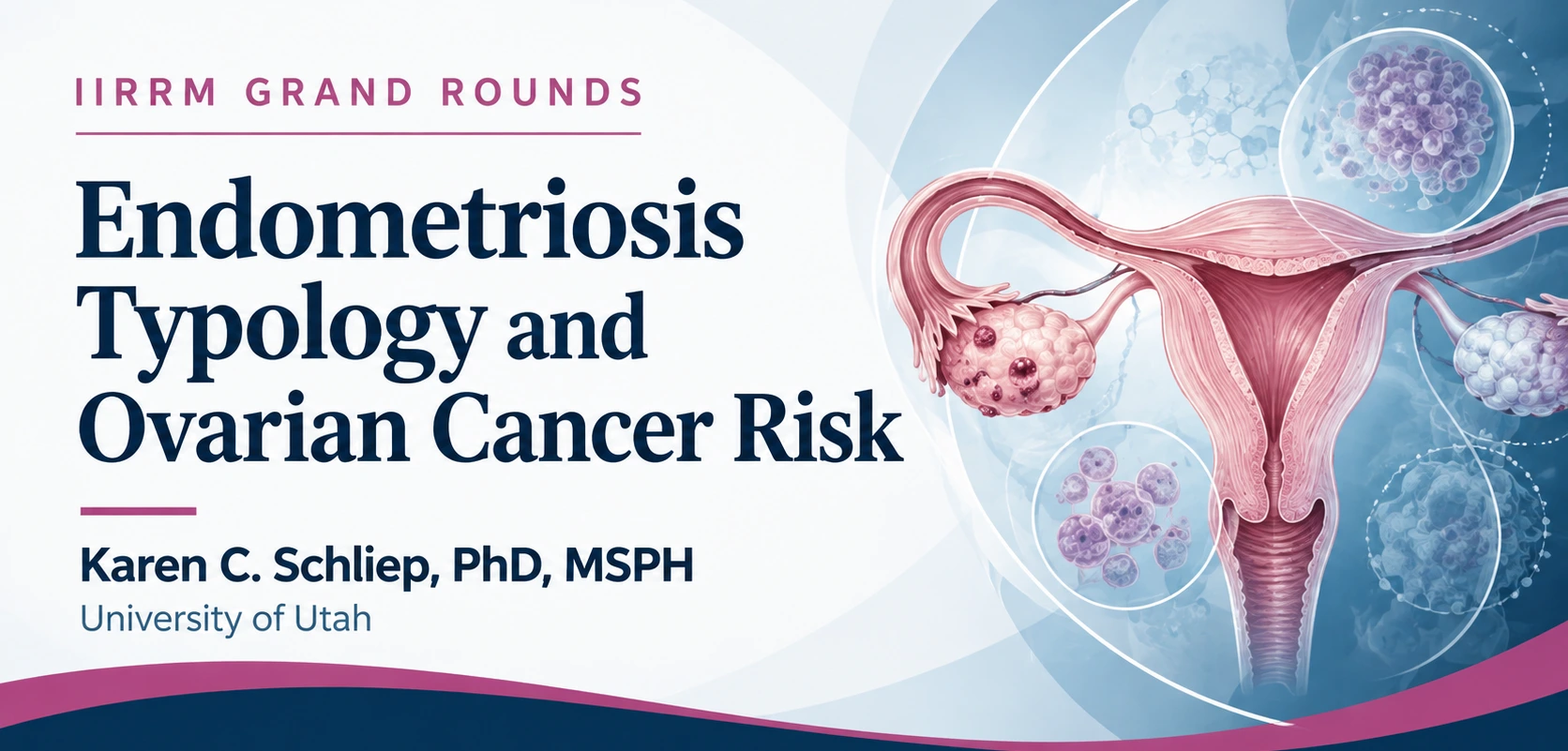 Endometriosis and Ovarian Cancer Risk